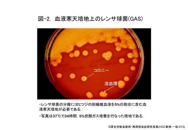 溶血 性 レンサ 球菌